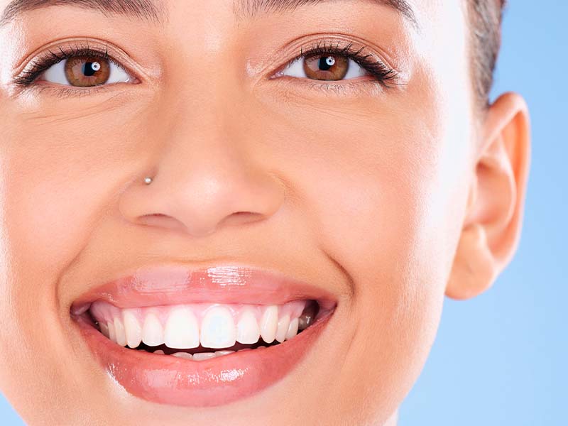 Person smiling for a dental X-ray guide