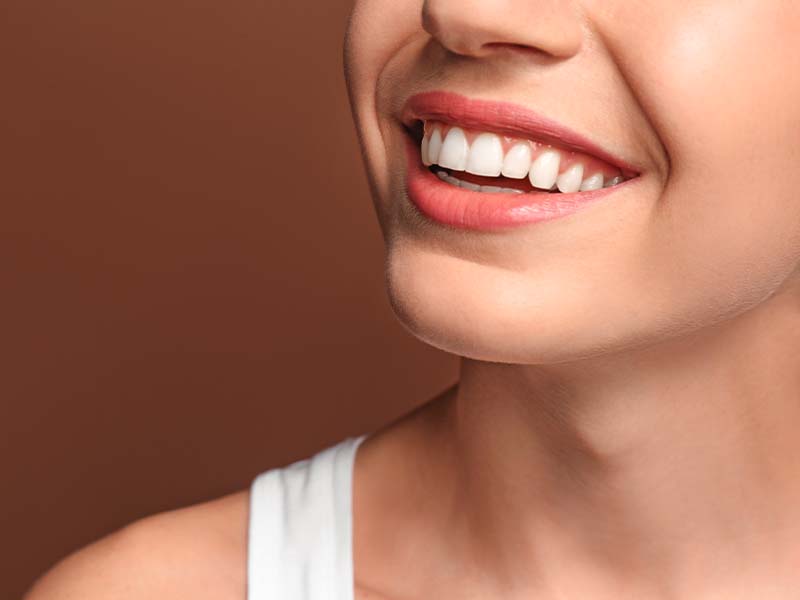 Healthy white smile