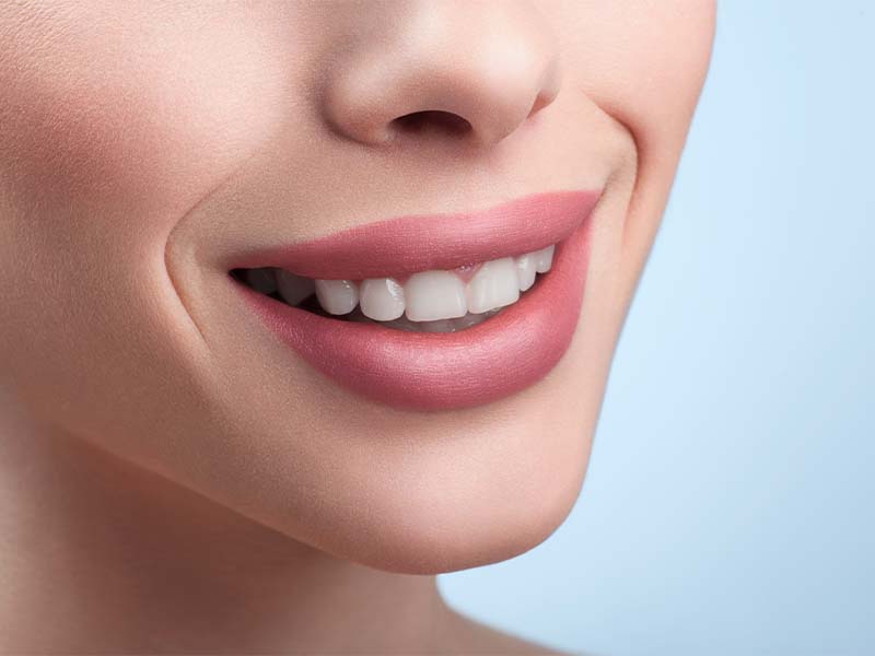 Person smiling for a cosmetic dentistry guide